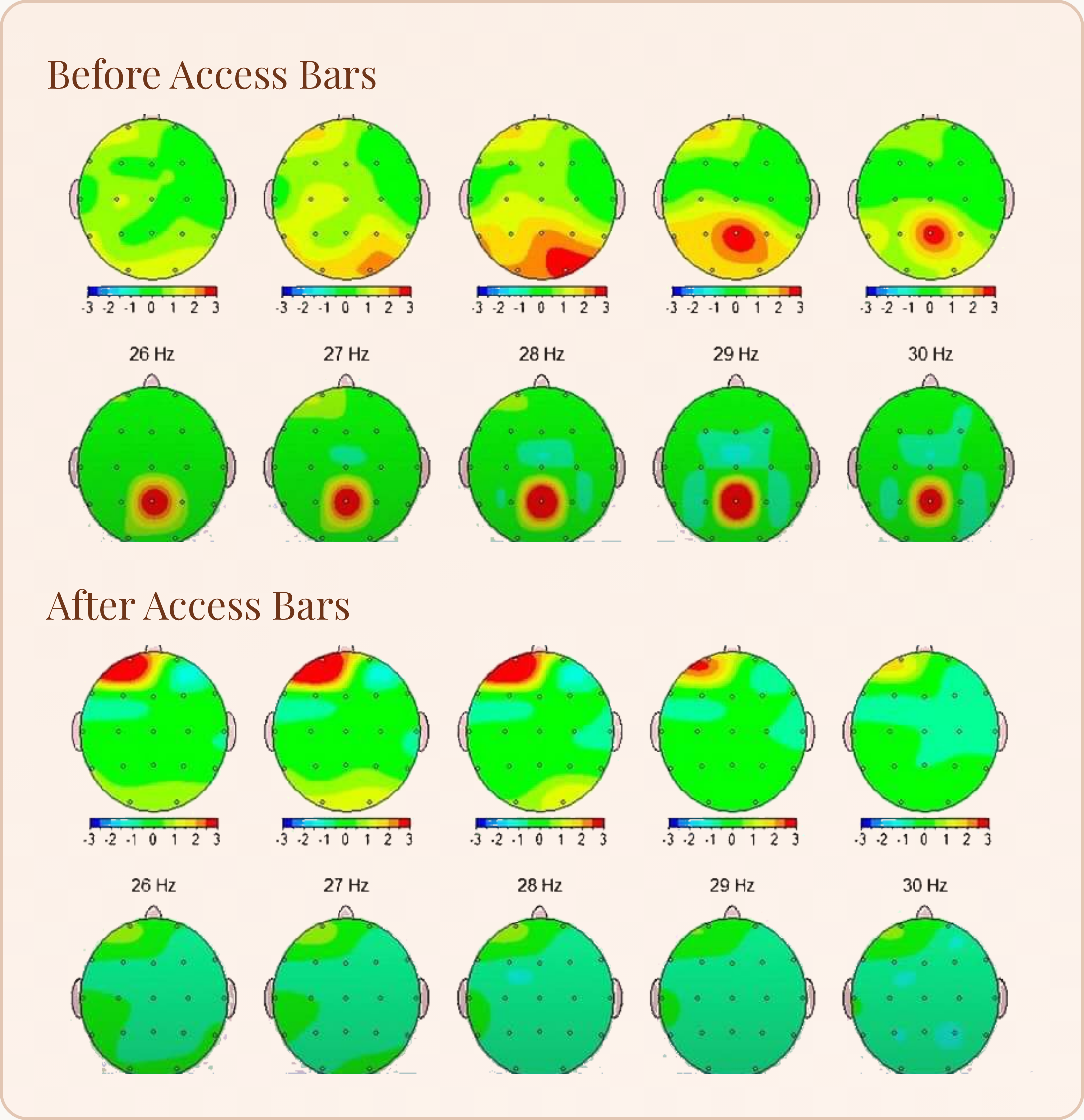 Brain activity maps before and after an Access Bars session